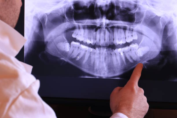 Best Emergency Dental Care for Broken or Chipped Teeth in Alderson, WV