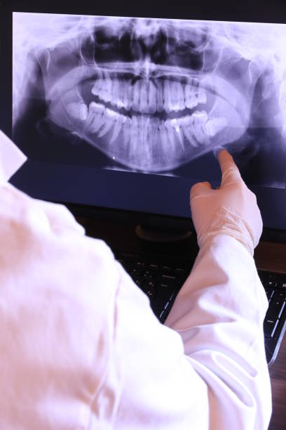 Best Emergency Wisdom Teeth Removal in Alderson, WV